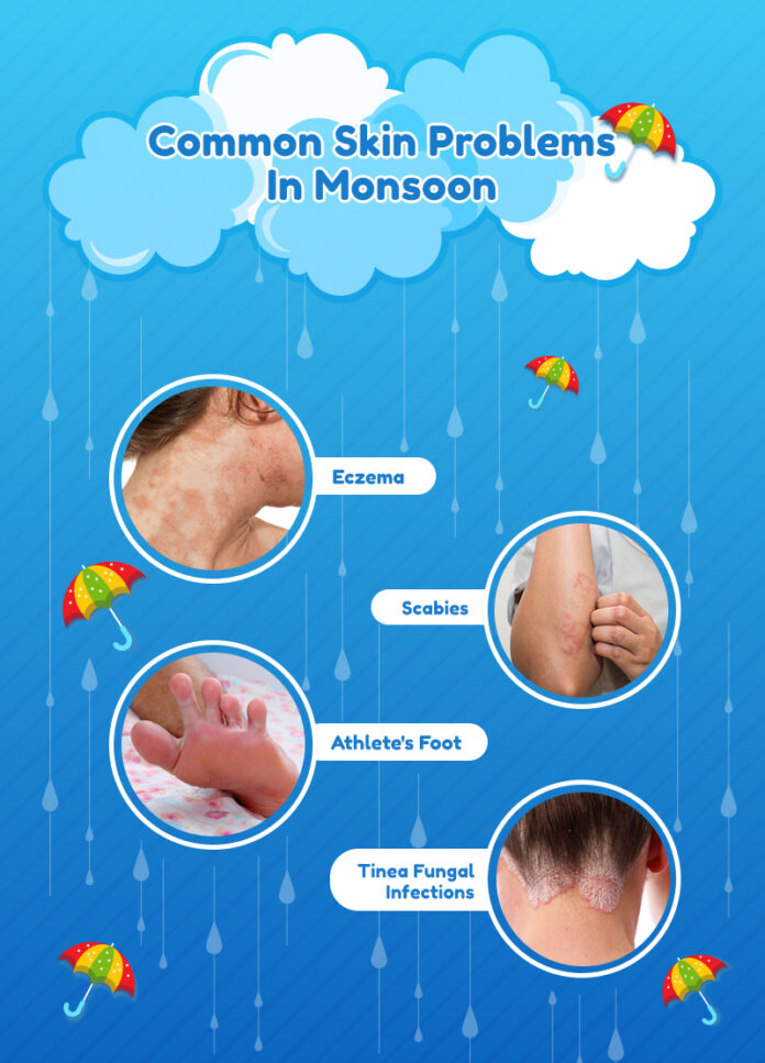 Skin Problems In Rainy Season