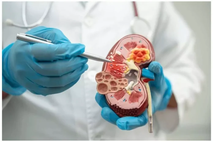 Kidney related diseases : गुर्दे शरीर के महत्वपूर्ण अंग, जानिए इससे जुड़ी बीमारियों के बारे में